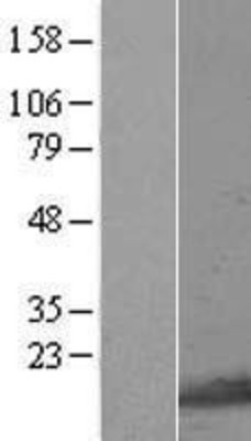 Western Blot: GNRPX Overexpression Lysate (Adult Normal) [NBL1-14511] Left-Empty vector transfected control cell lysate (HEK293 cell lysate); Right -Over-expression Lysate for GNRPX.