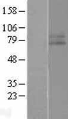 Western Blot: IFNGR1 Overexpression Lysate (Adult Normal) [NBL1-11852] Left-Empty vector transfected control cell lysate (HEK293 cell lysate); Right -Over-expression Lysate for IFNGR1.
