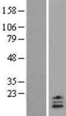 Western Blot: UCN2 Overexpression Lysate (Adult Normal) [NBL1-17581] Left-Empty vector transfected control cell lysate (HEK293 cell lysate); Right -Over-expression Lysate for UCN2.