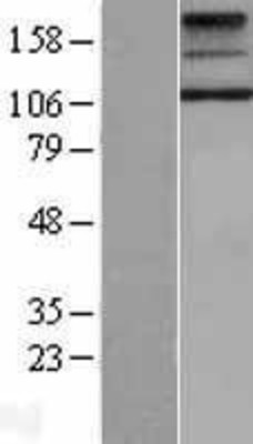 Western Blot: TSH Receptor Overexpression Lysate (Adult Normal) [NBL1-17361] Left-Empty vector transfected control cell lysate (HEK293 cell lysate); Right -Over-expression Lysate for TSH Receptor.