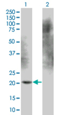 Lane 1: ARL3 transfected lysate (20.5 KDa). Lane 2: Non-transfected lysate.