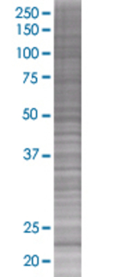 ARL3 transfected lysate