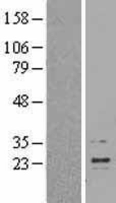 Western Blot: Interferon beta Overexpression Lysate (Adult Normal) [NBL1-11850] Left-Empty vector transfected control cell lysate (HEK293 cell lysate); Right -Over-expression Lysate for Interferon beta.