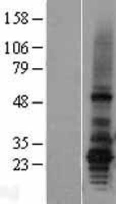Western Blot: AGPAT2 Overexpression Lysate (Adult Normal) [NBL1-07383] Left-Empty vector transfected control cell lysate (HEK293 cell lysate); Right -Over-expression Lysate for AGPAT2.
