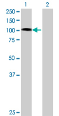 Lane 1: TROAP transfected lysate (85.69 KDa) Lane 2: Non-transfected lysate.