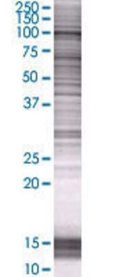 TROAP transfected lysate.