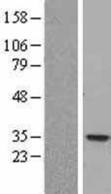 Western Blot: Nucleoside phosphorylase Overexpression Lysate (Adult Normal) [NBL1-13737] Left-Empty vector transfected control cell lysate (HEK293 cell lysate); Right -Over-expression Lysate for Nucleoside phosphorylase.
