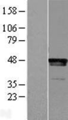 Western Blot: LHX2 Overexpression Lysate (Adult Normal) [NBL1-12514] Left-Empty vector transfected control cell lysate (HEK293 cell lysate); Right -Over-expression Lysate for LHX2.
