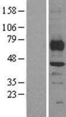 Western Blot: SMYD3 Overexpression Lysate (Adult Normal) [NBL1-16262] Left-Empty vector transfected control cell lysate (HEK293 cell lysate); Right -Over-expression Lysate for SMYD3.