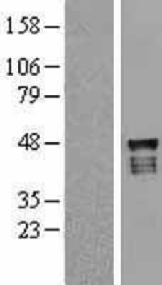 Western Blot: USP2 Overexpression Lysate (Adult Normal) [NBL1-17650] Left-Empty vector transfected control cell lysate (HEK293 cell lysate); Right -Over-expression Lysate for USP2.