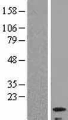 Western Blot: LC3B Overexpression Lysate (Adult Normal) [NBL1-12844] Left-Empty vector transfected control cell lysate (HEK293 cell lysate); Right -Over-expression Lysate for LC3B.