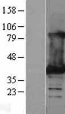 Western Blot: Lactate Dehydrogenase B Overexpression Lysate (Adult Normal) [NBL1-12472] Left-Empty vector transfected control cell lysate (HEK293 cell lysate); Right -Over-expression Lysate for Lactate Dehydrogenase B.