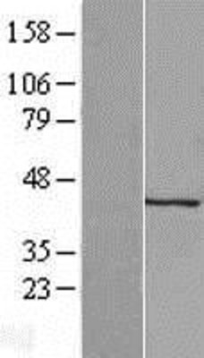 Western Blot: KERA Overexpression Lysate (Adult Normal) [NBL1-12228] Left-Empty vector transfected control cell lysate (HEK293 cell lysate); Right -Over-expression Lysate for KERA.