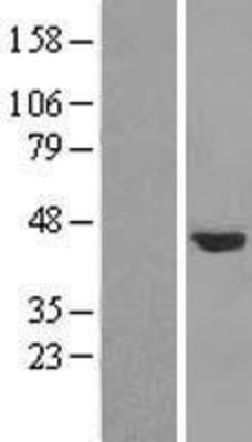 Western Blot: NUDCD3 Overexpression Lysate (Adult Normal) [NBL1-13851] Left-Empty vector transfected control cell lysate (HEK293 cell lysate); Right -Over-expression Lysate for NUDCD3.