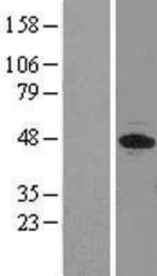 Western Blot: EIF3F Overexpression Lysate (Adult Normal) [NBL1-10194] Left-Empty vector transfected control cell lysate (HEK293 cell lysate); Right -Over-expression Lysate for EIF3F.
