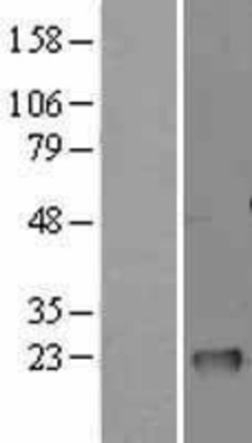 Western Blot: GM2A Overexpression Lysate (Adult Normal) [NBL1-11135] Left-Empty vector transfected control cell lysate (HEK293 cell lysate); Right -Over-expression Lysate for GM2A.