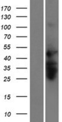Western Blot: RNF135 Overexpression Lysate (Adult Normal) [NBP2-10246] Left-Empty vector transfected control cell lysate (HEK293 cell lysate); Right -Over-expression Lysate for RNF135.