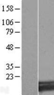 Western Blot: SNX3 Overexpression Lysate (Adult Normal) [NBL1-16314] Left-Empty vector transfected control cell lysate (HEK293 cell lysate); Right -Over-expression Lysate for SNX3.