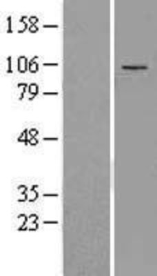 Western Blot: ADAMTS5 Overexpression Lysate (Adult Normal) [NBL1-07317] Left-Empty vector transfected control cell lysate (HEK293 cell lysate); Right -Over-expression Lysate for ADAMTS5.
