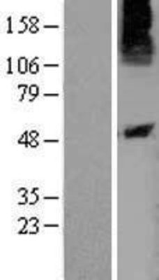 Western Blot: P2Y10 Overexpression Lysate (Adult Normal) [NBL1-14035] Left-Empty vector transfected control cell lysate (HEK293 cell lysate); Right -Over-expression Lysate for P2Y10.