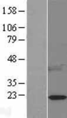 Western Blot: Leptin Overexpression Lysate (Adult Normal) [NBL1-12489] Left-Empty vector transfected control cell lysate (HEK293 cell lysate); Right -Over-expression Lysate for Leptin.