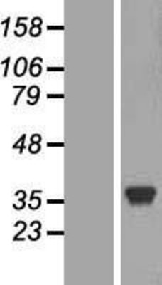 Western Blot: Lactate Dehydrogenase C Overexpression Lysate (Adult Normal) [NBL1-12473] Left-Empty vector transfected control cell lysate (HEK293 cell lysate); Right -Over-expression Lysate for Lactate Dehydrogenase C.