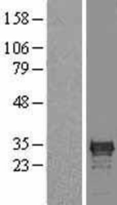 Western Blot: Cdx1 Overexpression Lysate (Adult Normal) [NBL1-09064] Left-Empty vector transfected control cell lysate (HEK293 cell lysate); Right -Over-expression Lysate for Cdx1.