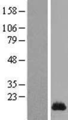Western Blot: SPRR1A Overexpression Lysate (Adult Normal) [NBL1-16430] Left-Empty vector transfected control cell lysate (HEK293 cell lysate); Right -Over-expression Lysate for SPRR1A.