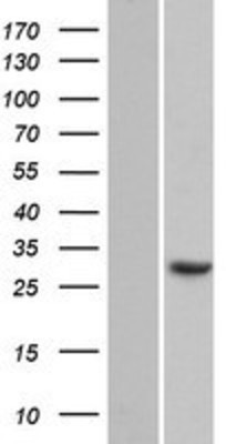 Western Blot: CCDC43 Overexpression Lysate (Adult Normal) [NBP2-05554] Left-Empty vector transfected control cell lysate (HEK293 cell lysate); Right -Over-expression Lysate for CCDC43.
