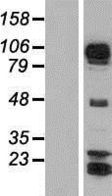 Western Blot: AFAP1L1 Overexpression Lysate (Adult Normal) [NBP2-05380] Left-Empty vector transfected control cell lysate (HEK293 cell lysate); Right -Over-expression Lysate for AFAP1L1.