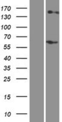 Western Blot: RHCE Overexpression Lysate (Adult Normal) [NBP2-05615] Left-Empty vector transfected control cell lysate (HEK293 cell lysate); Right -Over-expression Lysate for RHCE.