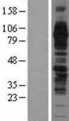 Western Blot: TGN38 Overexpression Lysate (Adult Normal) [NBL1-16869] Left-Empty vector transfected control cell lysate (HEK293 cell lysate); Right -Over-expression Lysate for TGN38.