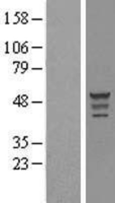 Western Blot: OLFML3 Overexpression Lysate (Adult Normal) [NBL1-13931] Left-Empty vector transfected control cell lysate (HEK293 cell lysate); Right -Over-expression Lysate for OLFML3.