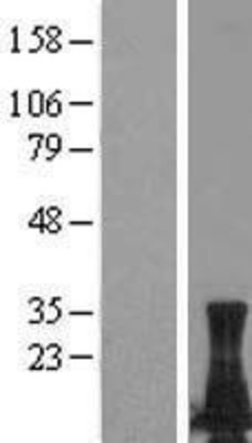 Western Blot: LIMD2 Overexpression Lysate (Adult Normal) [NBL1-12534] Left-Empty vector transfected control cell lysate (HEK293 cell lysate); Right -Over-expression Lysate for LIMD2.