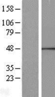 Western Blot: CANT1 Overexpression Lysate (Adult Normal) [NBP2-10196] Left-Empty vector transfected control cell lysate (HEK293 cell lysate); Right -Over-expression Lysate for CANT1.