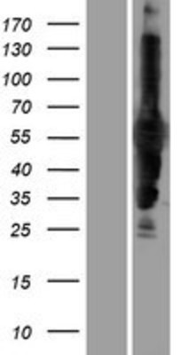 Western Blot: CARD9 Overexpression Lysate (Adult Normal) [NBP2-09950] Left-Empty vector transfected control cell lysate (HEK293 cell lysate); Right -Over-expression Lysate for CARD9.