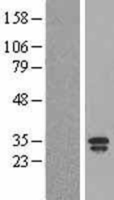 Western Blot: Lipocalin 2 Overexpression Lysate (Adult Normal) [NBL1-12463] Left-Empty vector transfected control cell lysate (HEK293 cell lysate); Right -Over-expression Lysate for Lipocalin 2.