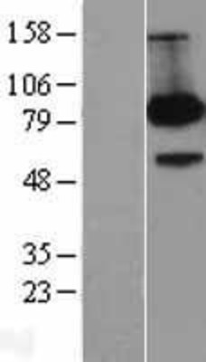 Western Blot: FE65 Overexpression Lysate (Adult Normal) [NBL1-07590] Left-Empty vector transfected control cell lysate (HEK293 cell lysate); Right -Over-expression Lysate for FE65.