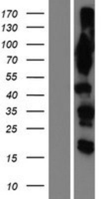Western Blot: OSBPL9 Overexpression Lysate (Adult Normal) [NBP2-09996] Left-Empty vector transfected control cell lysate (HEK293 cell lysate); Right -Over-expression Lysate for OSBPL9.
