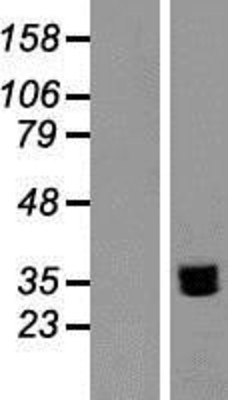 Western Blot: LY108 Overexpression Lysate (Adult Normal) [NBP2-05839] Left-Empty vector transfected control cell lysate (HEK293 cell lysate); Right -Over-expression Lysate for LY108.
