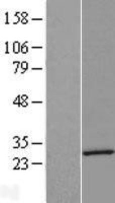 Western Blot: Dystrobrevin alpha Overexpression Lysate (Adult Normal) [NBP2-05941] Left-Empty vector transfected control cell lysate (HEK293 cell lysate); Right -Over-expression Lysate for Dystrobrevin alpha.