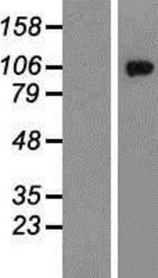 Western Blot: Glutamate Receptor 6 Overexpression Lysate (Native) [NBP2-06497] - Glutamate Receptor 6 Overexpression Lysate (Native) Left-Empty vector transfected control cell lysate (HEK293 cell lysate); Right -Over-expression Lysate for Glutamate receptor 6.
