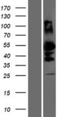 Western Blot: DMRTA1 Overexpression Lysate (Adult Normal) [NBP2-06454] Left-Empty vector transfected control cell lysate (HEK293 cell lysate); Right -Over-expression Lysate for DMRTA1.