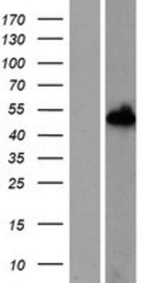 Western Blot: NXN Overexpression Lysate (Adult Normal) [NBP2-06438] Left-Empty vector transfected control cell lysate (HEK293 cell lysate); Right -Over-expression Lysate for NXN.