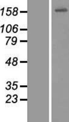 Western Blot: CEP164 Overexpression Lysate (Adult Normal) [NBP2-07245] Left-Empty vector transfected control cell lysate (HEK293 cell lysate); Right -Over-expression Lysate for CEP164.