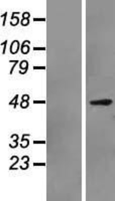 Western Blot: PAX7 Overexpression Lysate (Adult Normal) [NBP2-07395] Left-Empty vector transfected control cell lysate (HEK293 cell lysate); Right -Over-expression Lysate for PAX7.