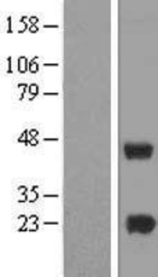 Western Blot: METTL7A Overexpression Lysate (Adult Normal) [NBP2-07376] Left-Empty vector transfected control cell lysate (HEK293 cell lysate); Right -Over-expression Lysate for METTL7A.