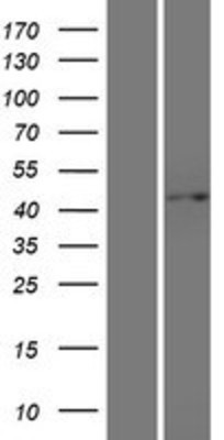 Western Blot: G protein alpha Overexpression Lysate (Adult Normal) [NBP2-05782] Left-Empty vector transfected control cell lysate (HEK293 cell lysate); Right -Over-expression Lysate for G protein alpha.