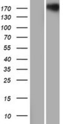 Western Blot: Robo1 Overexpression Lysate (Adult Normal) [NBP2-05697] Left-Empty vector transfected control cell lysate (HEK293 cell lysate); Right -Over-expression Lysate for Robo1.
