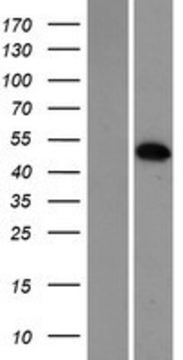 Western Blot: MXI1 Overexpression Lysate (Adult Normal) [NBP2-05743] Left-Empty vector transfected control cell lysate (HEK293 cell lysate); Right -Over-expression Lysate for MXI1.
